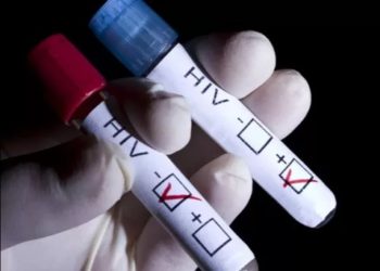 A woman who has had H.I.V. since 1992 has been cured of the virus without medication