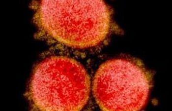 Uganda confirms new Covid strains