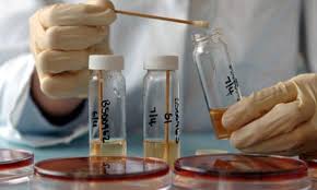 Anthrax Outbreak Hits Bushenyi District, Claims One Life