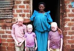 Uganda Strengthens Framework for Protecting the Rights and Wellbeing of Persons With Albinism