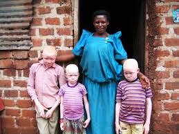 Uganda Strengthens Framework for Protecting the Rights and Wellbeing of Persons With Albinism